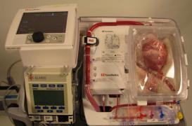 Greffe d’organes : les prélèvements « à cœur arrêté » autorisés